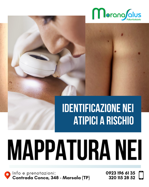 La #mappatura dei #nei è una tecnica diagnostica non invasiva che permette di tracciare una mappa dei nei presenti sul corpo permettendo così l'identificazione dei nei atipici e quindi a rischio rispetto a quelli normali. 